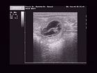 Ultra Sound 09.02.2009